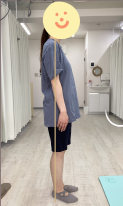 Before 姿勢改善前